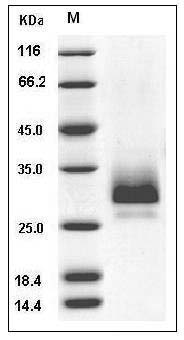 Mouse TFPI2 / PP5 Protein (His Tag) SDS-PAGE