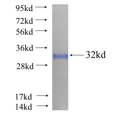 Recombinant human PLCB1 SDS-PAGE