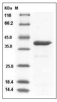 Human ARG1 / Arginase 1 Protein (His Tag) SDS-PAGE