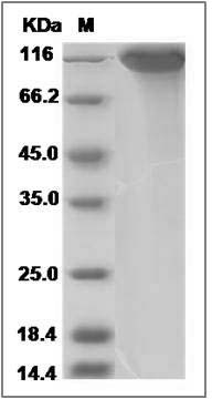 Rat SELP / selectin P / P-selectin Protein (His Tag) SDS-PAGE