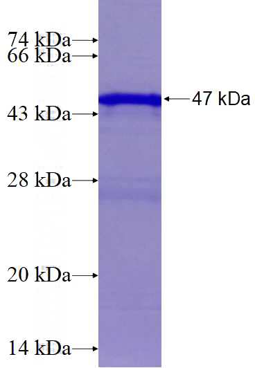 Recombinant Human RAB33A SDS-PAGE