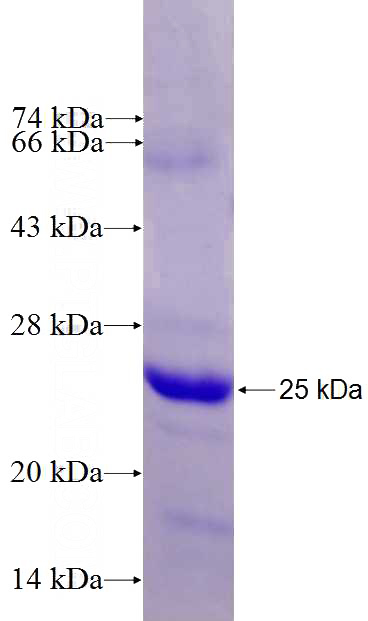 Recombinant Human DNAJB9 SDS-PAGE