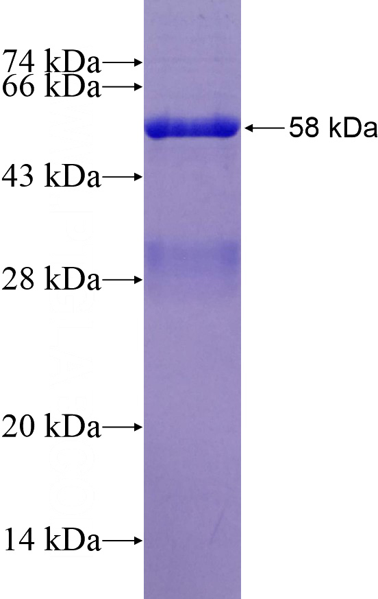 Recombinant Human CMAS SDS-PAGE