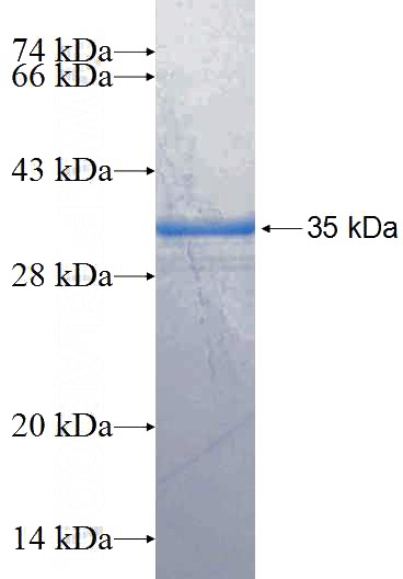 Recombinant Human PLEKHA1 SDS-PAGE