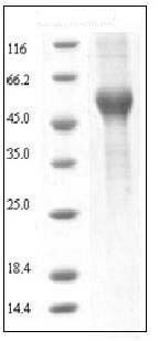 Rat ALK-1 / ACVRL1 Protein (His & Fc Tag) SDS-PAGE