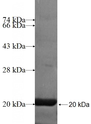 Recombinant Human PFDN6 SDS-PAGE