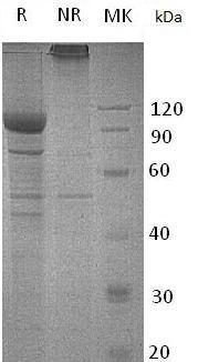 Human IL-35 (Fc tag) recombinant protein