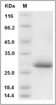 Cynomolgus Ephrin-A5 / EFNA5 Protein (His Tag) SDS-PAGE