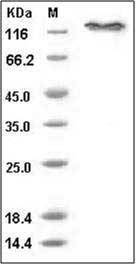 Human E-Selectin / CD62e / SELE Protein (His & Fc Tag) SDS-PAGE