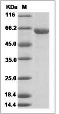 Influenza A H5N1 (A/bar-headed goose/Qinghai/1A/2005) Hemagglutinin / HA Protein (His Tag) SDS-PAGE