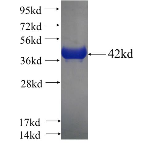 Recombinant human MATN2 SDS-PAGE