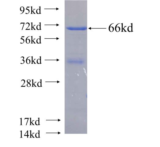 Recombinant human PATL1 SDS-PAGE