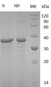 Human NRG1/GGF/HGL/HRGA/NDF/SMDF (His tag) recombinant protein