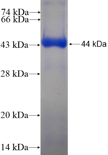 Recombinant Human ACOT12 SDS-PAGE