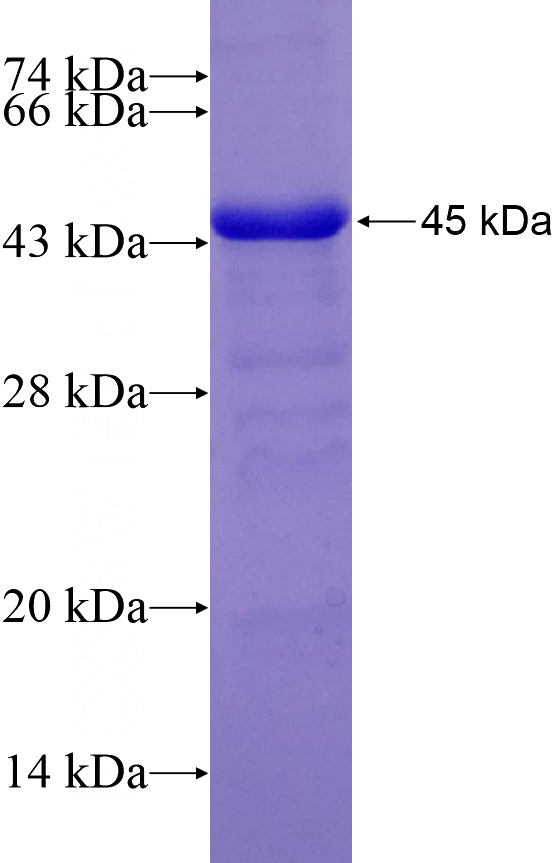 Recombinant Human RECQL4 SDS-PAGE
