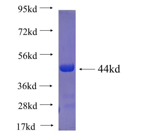 Recombinant human RARS2 SDS-PAGE