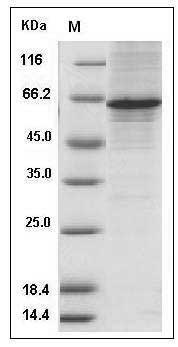 Mouse METAP2 / MAP2 Protein (His Tag) SDS-PAGE
