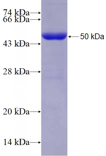 Recombinant Human KRT80 SDS-PAGE