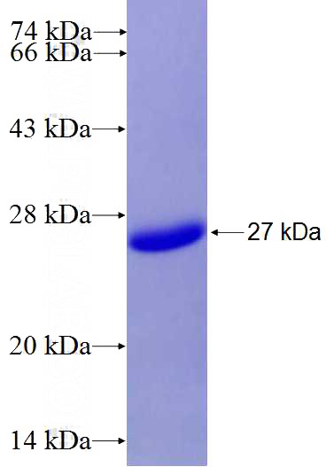 Human TNFRSF9 Recombinant protein (6*His tag)