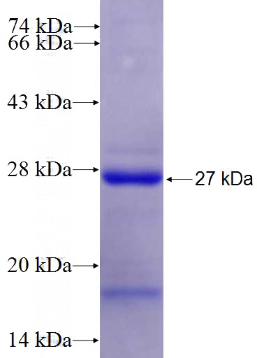 Recombinant Human RECK SDS-PAGE