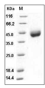 Human CD38 Protein (His Tag) SDS-PAGE