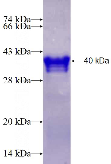 Recombinant Human HMGN1 SDS-PAGE