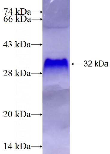Recombinant Human VWCE SDS-PAGE