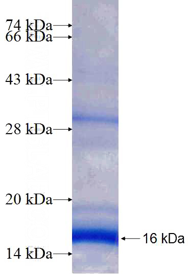 Recombinant Human NDUFS5 SDS-PAGE