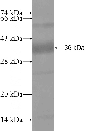 Recombinant Human CCDC53 SDS-PAGE