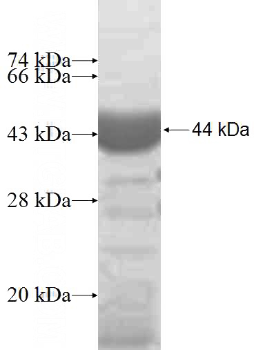 Recombinant Human COPB2 SDS-PAGE