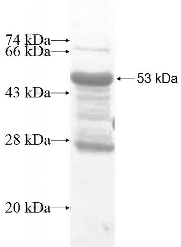 Recombinant Human PEX11G SDS-PAGE