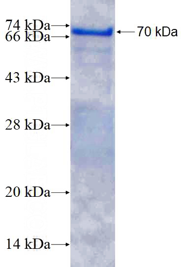 Recombinant Human CAST SDS-PAGE