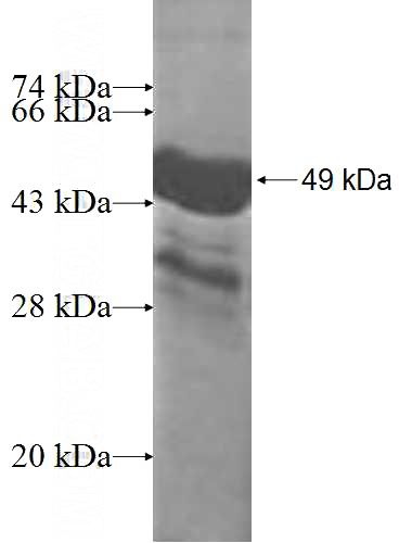 Recombinant Human LIN7B SDS-PAGE