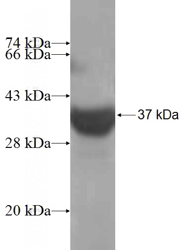Recombinant Human AZI2 SDS-PAGE
