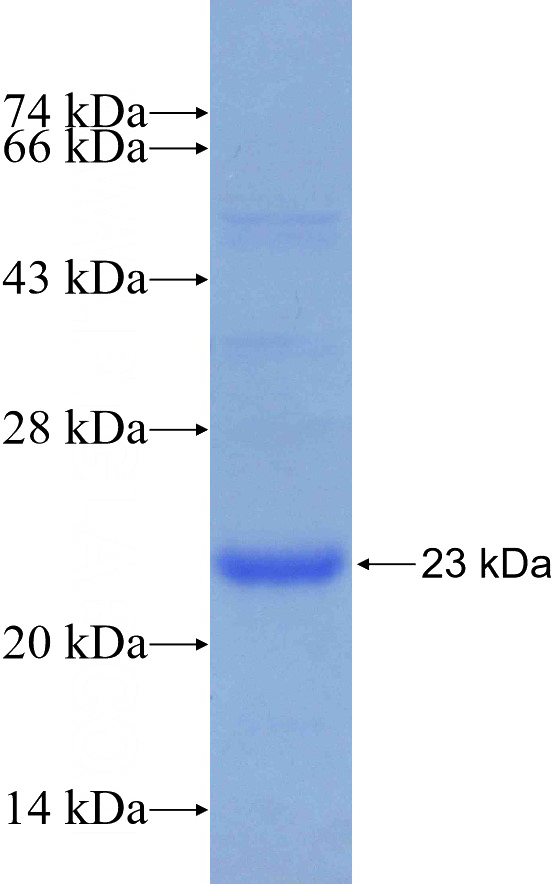 Recombinant Human NESP55,GNAS SDS-PAGE