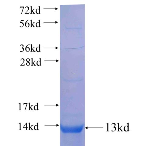 Recombinant human ANKS1B SDS-PAGE
