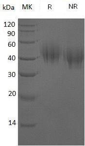 Human CD44/LHR/MDU2/MDU3/MIC4 (His tag) recombinant protein