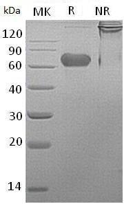 Human LTBR/D12S370/TNFCR/TNFR3/TNFRSF3 (Fc tag) recombinant protein