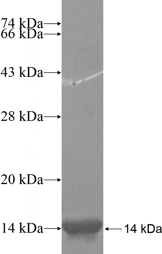 Recombinant Human SLC17A4 SDS-PAGE