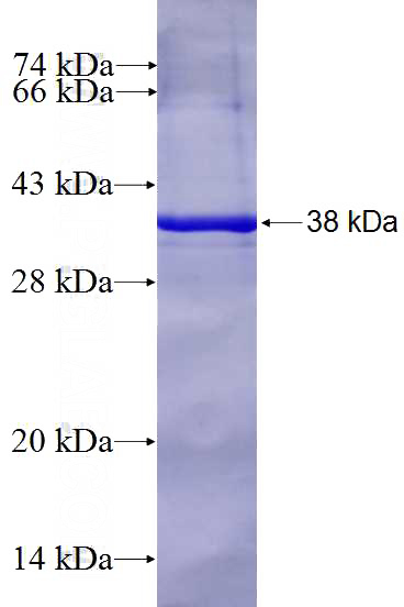 Recombinant Human ATP8A1 SDS-PAGE