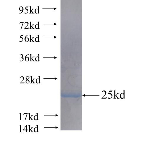 Recombinant human NAT5(Full length) SDS-PAGE