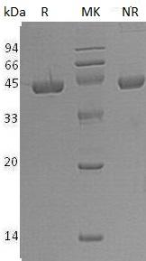 Human DHPS/DS (His tag) recombinant protein