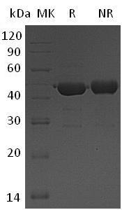 Human UBE2G2 (GST tag) recombinant protein
