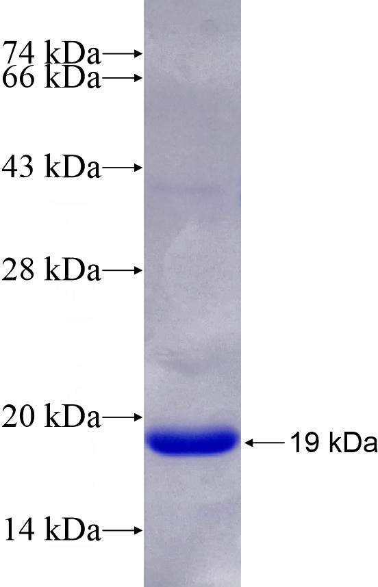 Recombinant Human SATB1 SDS-PAGE