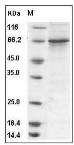 Human HER3 / ErbB3 Protein (aa 730-1065, His & GST Tag) SDS-PAGE