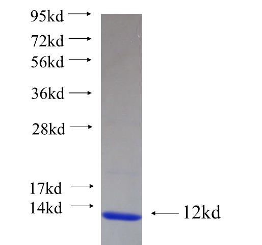 Recombinant human F2R SDS-PAGE