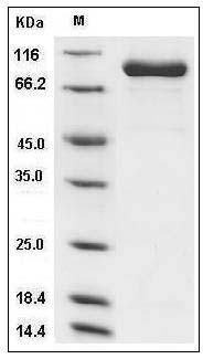 Human FAP / Seprase Protein (His Tag) SDS-PAGE
