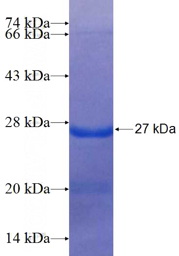 Recombinant Human CRKRS SDS-PAGE