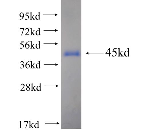 Recombinant human RHOBTB3 SDS-PAGE