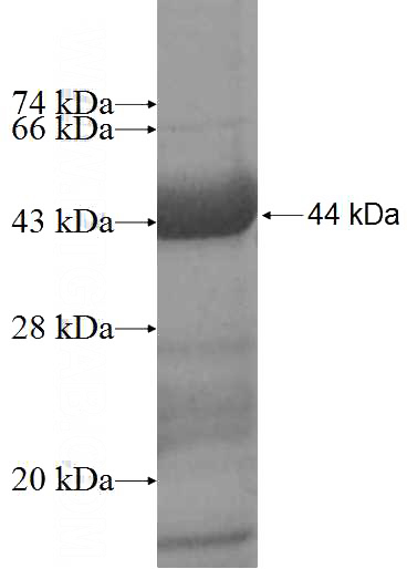 Recombinant Human TCN1 SDS-PAGE